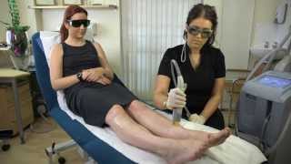 Cutera CoolGlide Laser Hair Removal  Patient Treatment Review  Refresh Laser Clinic Sheffield [upl. by Nohsid]