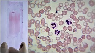 Blood Smear Preparation and Staining Practical Lab [upl. by Assilaj78]