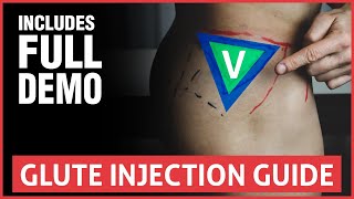 All You Need To Know About Joint Injections [upl. by Umont]