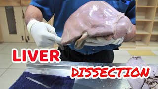 Anatomy Dissection of Liver [upl. by Yseult]