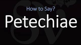 How to Pronounce Petechiae CORRECTLY Meaning amp Pronunciation [upl. by Yadrahc]