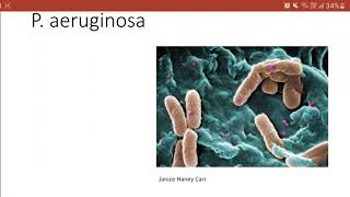 Batteriologia  Lezione 16 Pseudomonas aeruginosa [upl. by Yrrac]