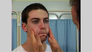 Facial nerve examination  Seventh cranial nerve [upl. by Nara]