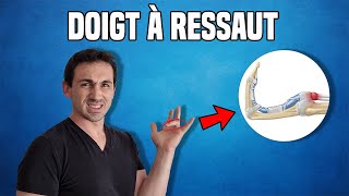 SOLUTIONS CONTRE LE DOIGT À RESSAUT  EXPLICATION ET EXERCICES KINÉ [upl. by Yvon]