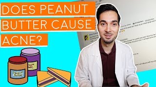 Does Peanut Butter Cause Acne  Responding To Your Comments [upl. by Ginsberg]