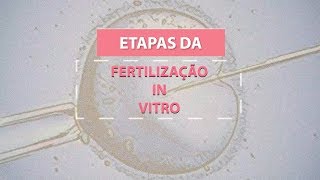 Etapas da fertilização in vitro [upl. by Reiners833]