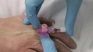 Cannulation How to gain IV access [upl. by Akcira]