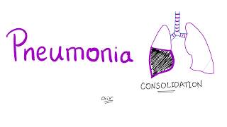 Pneumonia [upl. by Anaeda973]