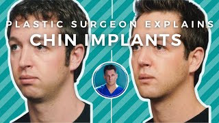 CHIN IMPLANTS EXPLAINED experience results recovery chin filler [upl. by Aniroc]