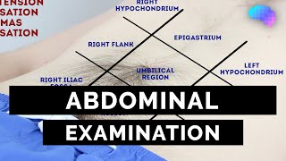 Abdominal Examination  OSCE Guide Latest  UKMLA  CPSA  PLAB 2 [upl. by Reldnahc]