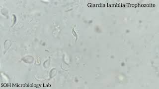 Giardia lamblia Trophozoite in stool [upl. by Abbi353]