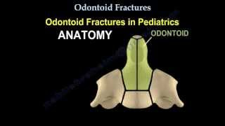 Odontoid Fractures  Everything You Need To Know  Dr Nabil Ebraheim [upl. by Alam43]