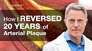 How I Reversed 20 years of Arterial Plaque [upl. by Nessy]