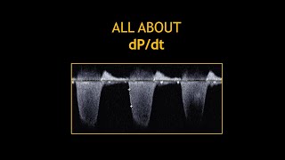 All about DPDT Echocardiography [upl. by Tate]