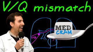 Ventilation Perfusion VQ Mismatch Explained Clearly [upl. by Anuahsar507]