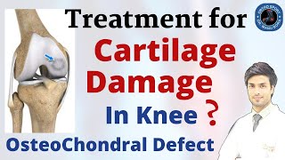 Knee Cartilage Damage Treatment  ChondralOsteochondral Defect Treatment Explained in Detail [upl. by Elrebma]