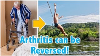 Arthritis can be Reversed [upl. by Chelsie]