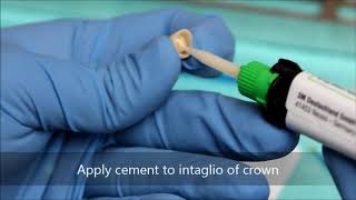 Bonding a zirconia crown [upl. by Yrekaz]