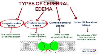 Cerebral edema [upl. by Averyl]