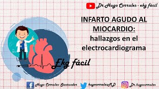 INFARTO AGUDO DE MIOCARDIO Hallazgos electrocardiográficos [upl. by Eatnuahs440]