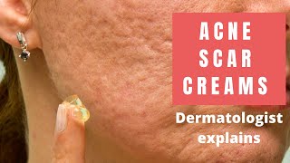 Acne Scar Creams  Dermatologist Reviews [upl. by Nare]