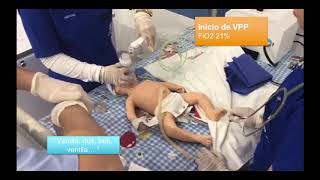 REANIMACION NEONATAL ALGORITMO COMPLETO [upl. by Katinka477]