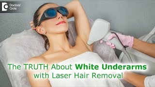 Myth or Fact Can laser hair removal procedure whiten underarmsDr Rashmi RavindraDoctors Circle [upl. by Mycah437]