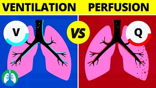 VentilationPerfusion VQ Ratio  Quick Medical Overview [upl. by Gilboa455]