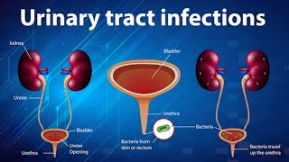 Sepsis Everything You Need to Know [upl. by Phionna260]