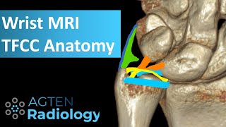 MRI Anatomy of TFCC [upl. by Leigh736]