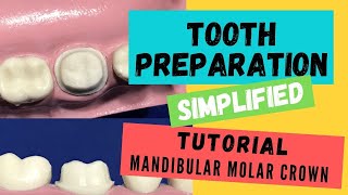 Zirconia Crown Preparation DEMONSTRATION Super Simplified [upl. by Lurie82]