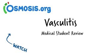 Vasculitis  Clinical Presentation [upl. by Harolda]