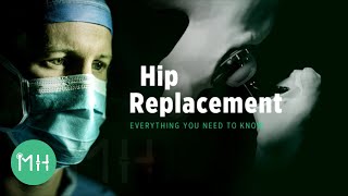 Hip Replacement  Everything you need to know [upl. by Maleeny]