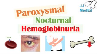 Paroxysmal Nocturnal Hemoglobinuria PNH  Causes amp Pathogenesis Symptoms Diagnosis amp Treatment [upl. by Ecinnahs]