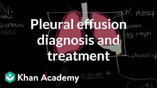 Pleural effusion diagnosis and treatment  Respiratory system diseases  NCLEXRN  Khan Academy [upl. by Kciregor376]