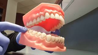 UniversalNational Tooth Numbering System [upl. by Balsam]