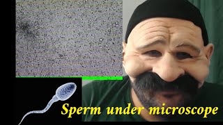 Sperm under microscope [upl. by Nylinej373]