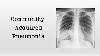 Community Acquired Pneumonia [upl. by Nnainot]