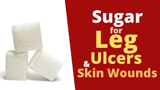 Sugar for Leg Ulcers and Skin Wounds  Very Effective [upl. by Cinda]