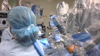 daVinci® SingleSite® Gallbladder Surgery  Middlesex Hospital [upl. by Puna]