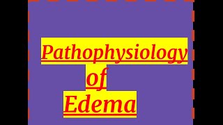 PATHOLOGY OF EDEMA [upl. by Nhabois]