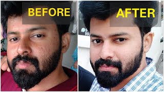 Get brighter skin Naturally in 2 Weeks  No side effects  Tamil  shadhikazeez [upl. by Layne]