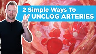 2 Simple Ways To Unclog And Decalcify Your Arteries [upl. by Akenihs]