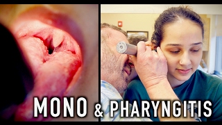 MONO amp PHARYNGITIS Crazy Story  Dr Paul [upl. by Rossie561]