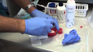 Denture Soft Reline Part 1 [upl. by Ubana]