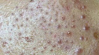 Satisfying With Loan Nguyen Spa Video 004 [upl. by Atikahc687]