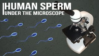 Human Sperm under the microscope [upl. by Si340]