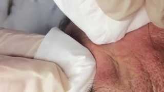 How To Remove a Whitehead Soft Sebum [upl. by Aliber]