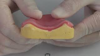 Denture Relining Rebase [upl. by Burck139]