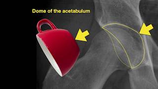 Anatomy of Hip Xrays [upl. by Llieno220]